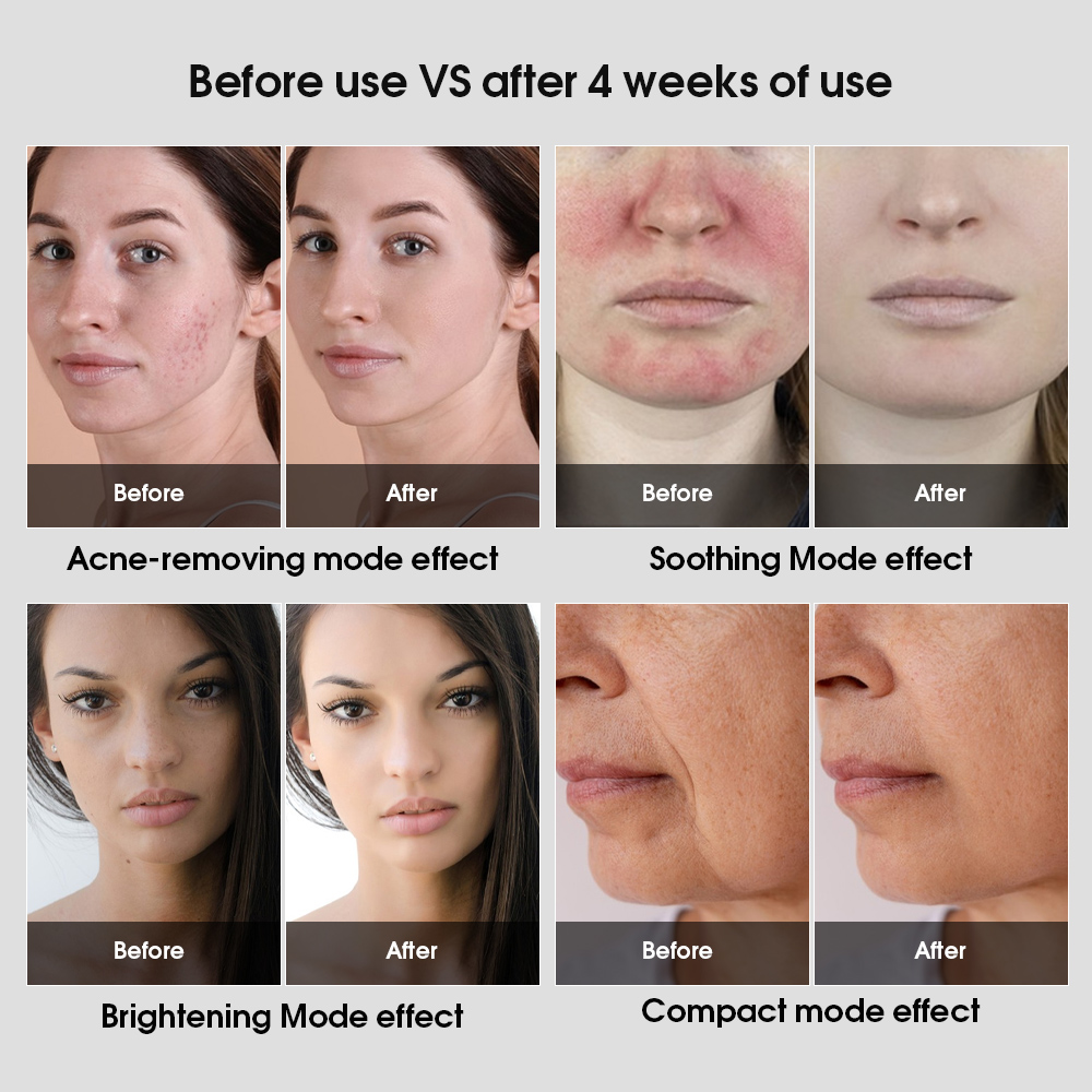 Professional 5 Color LED Light Therapy Panel 10mm Ultra Slim for Clinics And Spas